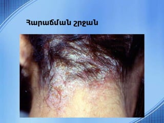 Հարաճման շրջան
 