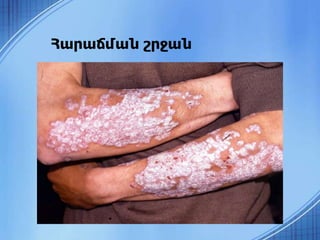 Հարաճման շրջան
 