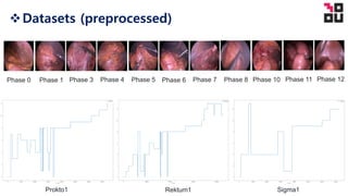 vDatasets (preprocessed)
Prokto1 Rektum1 Sigma1
Phase 0 Phase 1 Phase 3 Phase 4 Phase 5 Phase 6 Phase 7 Phase 8 Phase 10 Phase 11 Phase 12
 