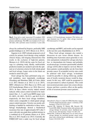 always be confirmed by biopsies, preferably MRI
guided (Siddiqui et al. 2015; Moore et al. 2013).
Eggener et al. (2007) already proposed a set of
criteria for primary focal therapy using multiple
clinical, biopsy, and imaging characteristics that
results in the exclusion of high-risk patients.
Moman et al. (2010) did the same for focal sal-
vage in a planning study. Ideally, multivariable
prediction models are needed to provide the opti-
mal set of selection criteria for both whole-gland
and focal salvage. Larger series in the future are
needed to attain this goal.
Focal salvage has been performed using sev-
eral modalities, most importantly cryotherapy
(Eisenberg and Shinohara 2008; de Castro Abreu
et al. 2013; Bomers et al. 2013; Li et al. 2015),
HIFU (Ahmed et al. 2012; Baco et al. 2014), and
I125 brachytherapy (Peters et al. 2014; Hsu et al.
2013). In these cohorts toxicity indeed seemed
reduced, while cancer control seemed to be main-
tained. One-, 2-, 3-, and 5-year BDFS ranges were
83–100 %, 49–100 %, 50–91 %, and 46.5–54.4 %,
respectively, for these focal salvage modalities,
which seems comparable to whole-­gland salvage
cancer control outcomes. Toxicity was mostly self-
limiting or handled by medication in these series.
Salvage brachytherapy showed a biochemical
recurrence-free rate of approximately 60 % after 3
years with only one grade three urethral stricture in
a combined set of 42 patients (Peters et al. 2014;
Hsu et al. 2013; Sasaki et al. 2013). Currently, the
FORECAST trial is under way for focal salvage
cryotherapy and HIFU, and results can be expected
in the next few years (Kanthabalan et al. 2015).
These focal salvage strategies also started a
discussion on cure versus chronic disease. As
doubling time of prostate cancer generally is very
slow and patients evaluated for salvage only have
low- to intermediate-risk features and probably
an advanced age, it remains questionable whether
salvage will be able to improve survival. Most of
these patients would probably not die from their
prostate cancer. If acceptable toxicity rates could
be achieved with focal salvage, re-treatment
would be possible if, during follow-up, another
area of locally recurrent disease would be diag-
nosed. In this way, ADT could be postponed or
even prevented in a subset of patients. This could
turn recurrent prostate cancer into a more chronic
disease and have a positive effect on the quality
of life of recurrent prostate cancer patients.
References
Abuzallouf S, Dayes I, Lukka H (2004) Baseline staging
of newly diagnosed prostate cancer: a summary of the
literature. J Urol 171:2122–2127
Agarwal PK, Sadetsky N, Konety BR, Resnick MI,
Carroll PR (2008) Treatment failure after primary and
salvage therapy for prostate cancer: likelihood, pat-
terns of care, and outcomes. Cancer 112:307–314
Ahmed HU, Cathcart P, McCartan N et al (2012) Focal
salvage therapy for localized prostate cancer recur-
rence after external beam radiotherapy: a pilot study.
Cancer 118:4148–4155
Fig. 4  From left to right: transversal T2-weighted, DWI
and DCE-MRI for a locally recurrent prostate tumor after
primary radiotherapy. This MR is an example of a 67-year-­
old male, with a prostate cancer recurrence 3 years after
primary I-125 brachytherapy treatment. PSA before sal-
vage treatment was 5.4 ng/ml. After salvage treatment,
PSA decreased to 1.0 ng/ml
Prostate Cancer
 