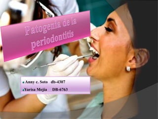 Patogenia de la periodontitis Anny c. Soto   db-4307 Yarisa Mejía     DB-6763 
