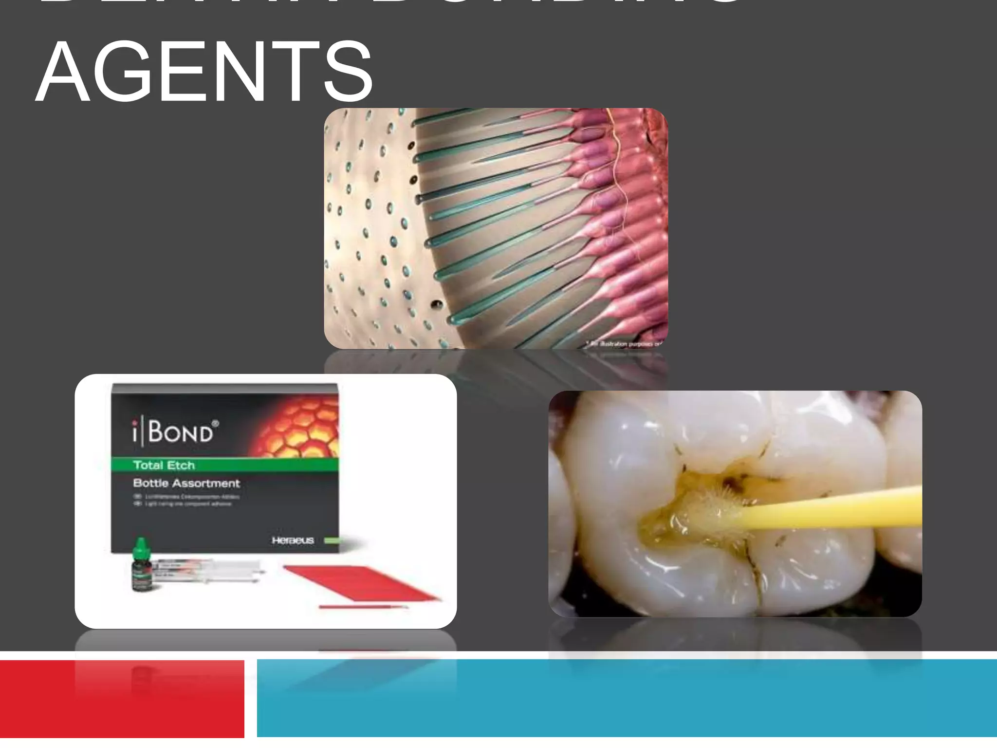 DENTIN BONDING AGENTS PPT