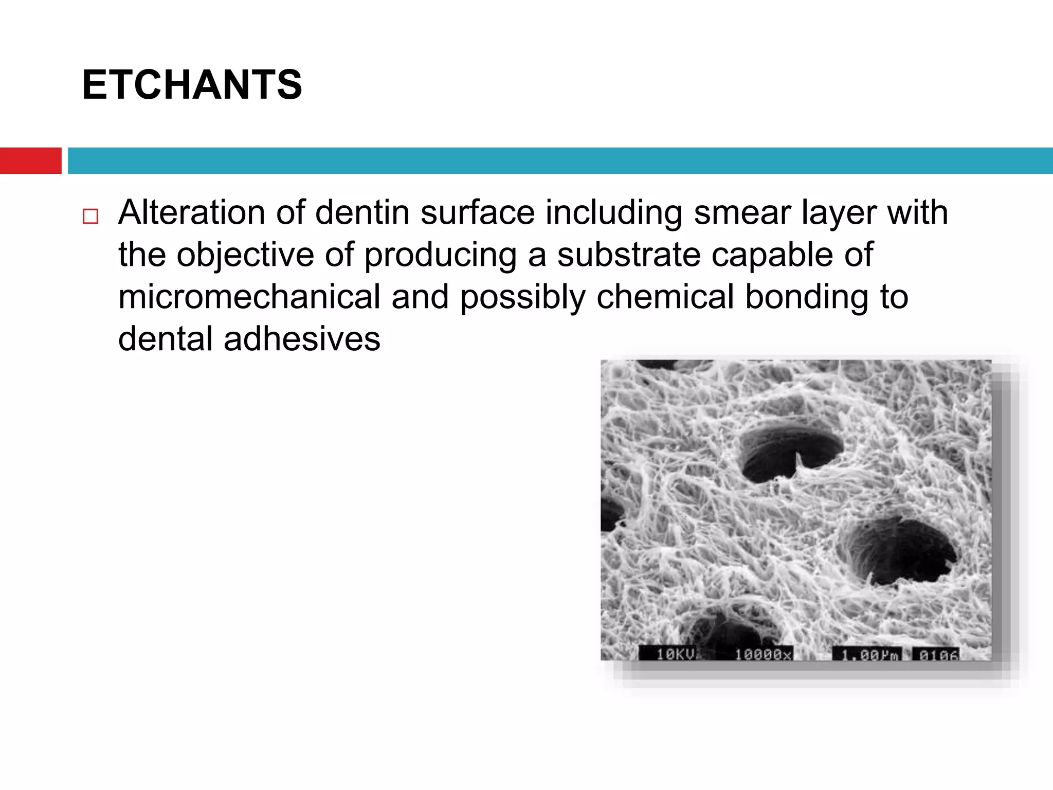 DENTIN BONDING AGENTS | PPTX