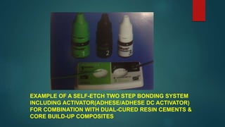 EXAMPLE OF A SELF-ETCH TWO STEP BONDING SYSTEM
INCLUDING ACTIVATOR(ADHESE/ADHESE DC ACTIVATOR)
FOR COMBINATION WITH DUAL-CURED RESIN CEMENTS &
CORE BUILD-UP COMPOSITES
 
