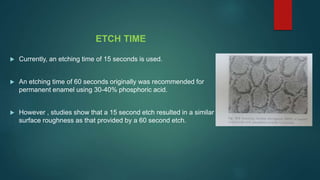 ETCH TIME
 Currently, an etching time of 15 seconds is used.
 An etching time of 60 seconds originally was recommended for
permanent enamel using 30-40% phosphoric acid.
 However , studies show that a 15 second etch resulted in a similar
surface roughness as that provided by a 60 second etch.
 