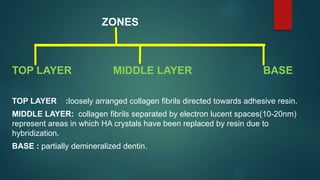 ZONES
TOP LAYER MIDDLE LAYER BASE
TOP LAYER :loosely arranged collagen fibrils directed towards adhesive resin.
MIDDLE LAYER: collagen fibrils separated by electron lucent spaces(10-20nm)
represent areas in which HA crystals have been replaced by resin due to
hybridization.
BASE : partially demineralized dentin.
 