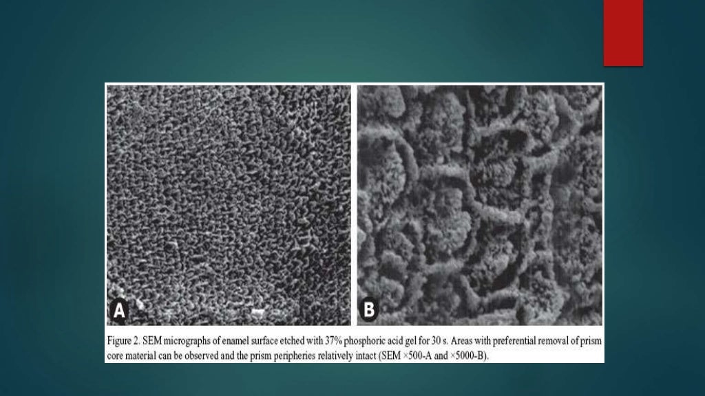 dentin bonding agents