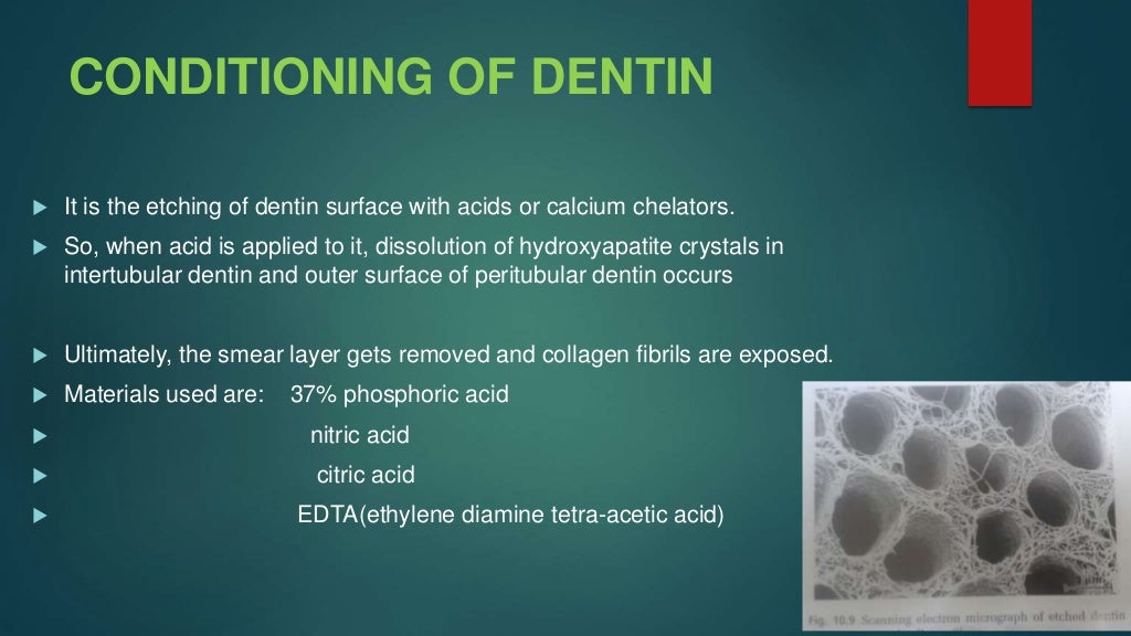dentin bonding agents