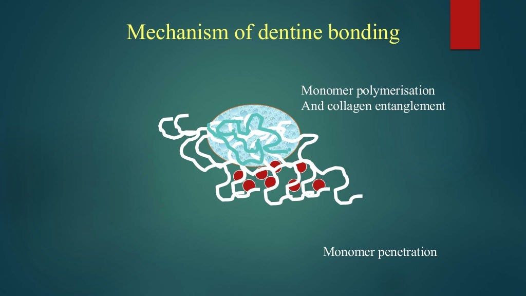 dentin bonding agents