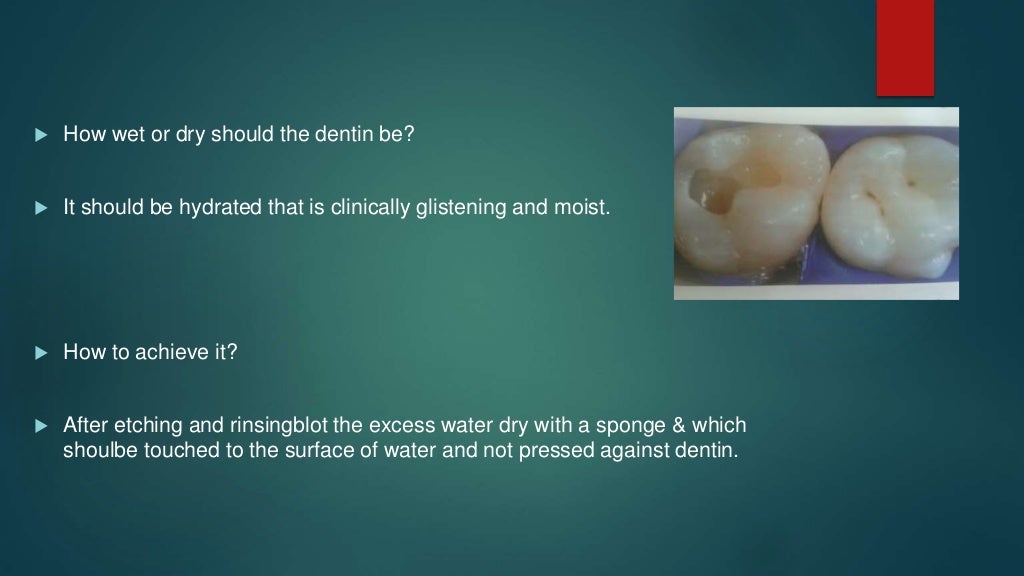 dentin bonding agents