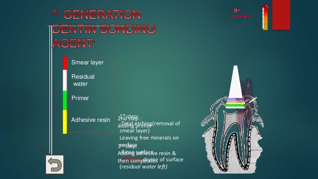dentin bonding agents