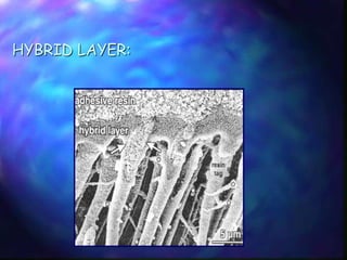 DENTIN BONDING AGENTS | PPT