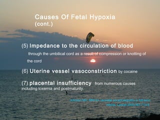 Causes Of Fetal Hypoxia
             (cont.)



      (5) Impedance to the circulation of blood
         through the umbilical cord as a result of compression or knotting of
         the cord

      (6) Uterine vessel vasoconstriction                         by cocaine


      (7) placental insufficiency                 from numerous causes
      including toxemia and postmaturity.

                                 Johnson MV: MRI for neonatal encephalopathy in full-term
                                                         infants. Lancet 2003;361:713-4


05/26/2010               Khorfakkan Hospital Pediatric Department
                                                         11
 
