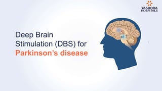Deep Brain
Stimulation (DBS) for
Parkinson’s disease
 