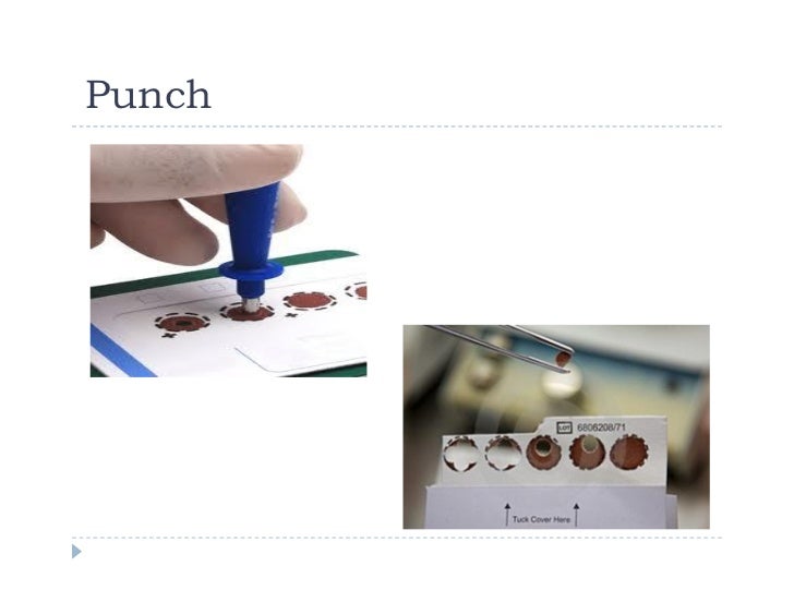 dry blood spotting technique,DBS