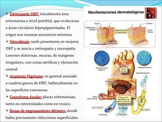  Dermopatía DBT: inicialmente área
eritematosa a nivel pretibial, que evoluciona
a áreas circulares hiperpigmentadas. El
origen son traumas mecánicos mínimos.
 Necrobiosis: suele presentarse en mujeres
Necrobiosis
DBT y se asocia a retinopatía y neuropatía.
Lesiones dolorosas, oscuras, de márgenes
irregulares, con zonas atróficas y ulceración
central.
 Acantosis Nigricans: en general asociado
a cuadros graves de DBT, habitualmente en
las superficies extensoras.
 Granuloma Anular: placas eritematosas,
tanto en extremidades como en tronco.
 Zonas de engrosamiento dérmico: donde
había previamente infecciones superficiales.

 