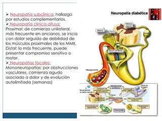 Neuropat ía subclínica:  hallazgo por estudios complementarios. Neuropatía clínica difusa:   Proximal : de comienzo unilateral, más frecuente en ancianos, se inicia con dolor seguido de debilidad de los músculos proximales de los MMII.  Distal:  lo más frecuente, puede presentar compromiso sensitivo o motor. Neuropatías focales:   Mononeuropatías:  por obstrucciones vasculares, comienzo agudo asociado a dolor y de evolución autolimitada (semanas) 