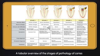 Place your screenshot here
A tabular overview of the stages of pathology of caries
 