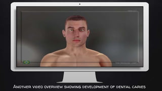 Place your screenshot here
Another video overview showing development of dental caries
 