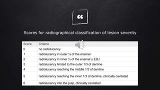 “
Score Criteria
0 no radiolucency
1 radiolucency in outer ½ of the enamel
2 radiolucency in inner ½ of the enamel ± EDJ
3 radiolucency limited to the outer 1/3 of dentine
4 radiolucency reaching the middle 1/3 of dentine
5 radiolucency reaching the inner 1/3 of dentine, clinically cavitated
6 radiolucency into the pulp, clinically cavitated
Scores for radiographical classification of lesion severity
 