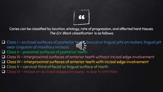 “Caries can be classified by location, etiology, rate of progression, and affected hard tissues.
The G.V. Black classification is as follows:
 Class I – occlusal surfaces of posterior teeth, buccal or lingual pits on molars, lingual pit
near cingulum of maxillary incisors
 Class II – proximal surfaces of posterior teeth
 Class III – interproximal surfaces of anterior teeth without incisal edge involvement
 Class IV – interproximal surfaces of anterior teeth with incisal edge involvement
 Class V – cervical third of facial or lingual surface of tooth
 Class VI – incisal or occlusal edgeworn away is due to attrition
 