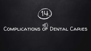 14.
Complications of Dental Caries
 