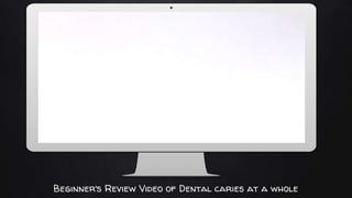 Place your screenshot here
Beginner’s Review Video of Dental caries at a whole
 