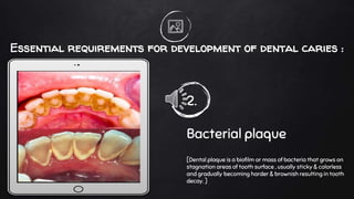 Essential requirements for development of dental caries :
2.
Bacterial plaque
[Dental plaque is a biofilm or mass of bacteria that grows on
stagnation areas of tooth surface , usually sticky & colorless
and gradually becoming harder & brownish resulting in tooth
decay. ]
 