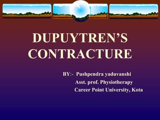 DUPUYTREN’S
CONTRACTURE
BY:- Pushpendra yaduvanshi
Asst. prof. Physiotherapy
Career Point University, Kota
 