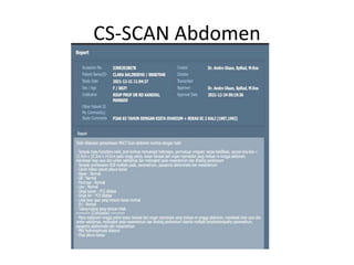CS-SCAN Abdomen
 