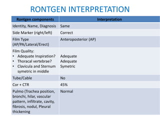 RONTGEN INTERPRETATION
Rontgen components Interpretation
Identity, Name, Diagnosis Same
Side Marker (right/left) Correct
Film Type
(AP/PA/Lateral/Erect)
Anteroposterior (AP)
Film Quality:
• Adequate Inspiration?
• Thoracal vertebrae?
• Clavicula and Sternum
symetric in middle
Adequate
Adequate
Symetric
Tube/Cable No
Cor + CTR 45%
Pulmo (Trachea position,
bronchi, hilar, vascular
pattern, infiltrate, cavity,
fibrosis, nodul, Pleural
thickening
Normal
 