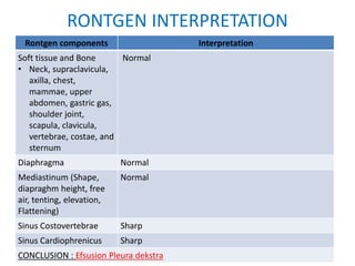 RONTGEN INTERPRETATION
Rontgen components Interpretation
Soft tissue and Bone
• Neck, supraclavicula,
axilla, chest,
mammae, upper
abdomen, gastric gas,
shoulder joint,
scapula, clavicula,
vertebrae, costae, and
sternum
Normal
Diaphragma Normal
Mediastinum (Shape,
diapraghm height, free
air, tenting, elevation,
Flattening)
Normal
Sinus Costovertebrae Sharp
Sinus Cardiophrenicus Sharp
CONCLUSION : Efsusion Pleura dekstra
 