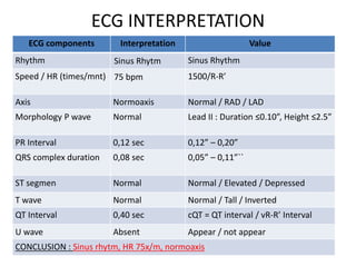ECG INTERPRETATION
ECG components Interpretation Value
Rhythm Sinus Rhytm Sinus Rhythm
Speed / HR (times/mnt) 75 bpm 1500/R-R’
Axis Normoaxis Normal / RAD / LAD
Morphology P wave Normal Lead II : Duration ≤0.10”, Height ≤2.5”
PR Interval 0,12 sec 0,12” – 0,20”
QRS complex duration 0,08 sec 0,05” – 0,11”``
ST segmen Normal Normal / Elevated / Depressed
T wave Normal Normal / Tall / Inverted
QT Interval 0,40 sec cQT = QT interval / vR-R’ Interval
U wave Absent Appear / not appear
CONCLUSION : Sinus rhytm, HR 75x/m, normoaxis
 