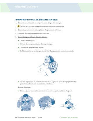 125 | Secourisme en milieu de travail | 7e
édition
Interventions en cas de blessures aux yeux
1.	 S’assurer que la situation ne comporte aucun danger et se protéger.
2.		 Vérifier l’état de conscience en maintenant une protection cervicale.
3.	 S’assurer que les services préhospitaliers d’urgence sont prévenus.
4.	 Contrôler tous les problèmes trouvés dans L’ABC.
5.	 Corps étranger pénétrant et autres lésions :
	 Laisser l’objet en place ;
	 Déposer des compresses autour du corps étranger ;
	 Couvrir d’un verre de carton et fixer ;
	 En l’absence d’un corps étranger, couvrir l’œil d’un pansement sec non compressif ;
	 Installer la personne en position semi-assise, s’il s’agit d’un corps étranger pénétrant et
qu’elle ne souffre d’aucun traumatisme à la colonne.
	 Brûlure chimique :
	 Rincer à grande eau en attendant l’arrivée des services préhospitaliers d’urgence.
Blessures aux yeux
	 Retour à la Table des matières
 