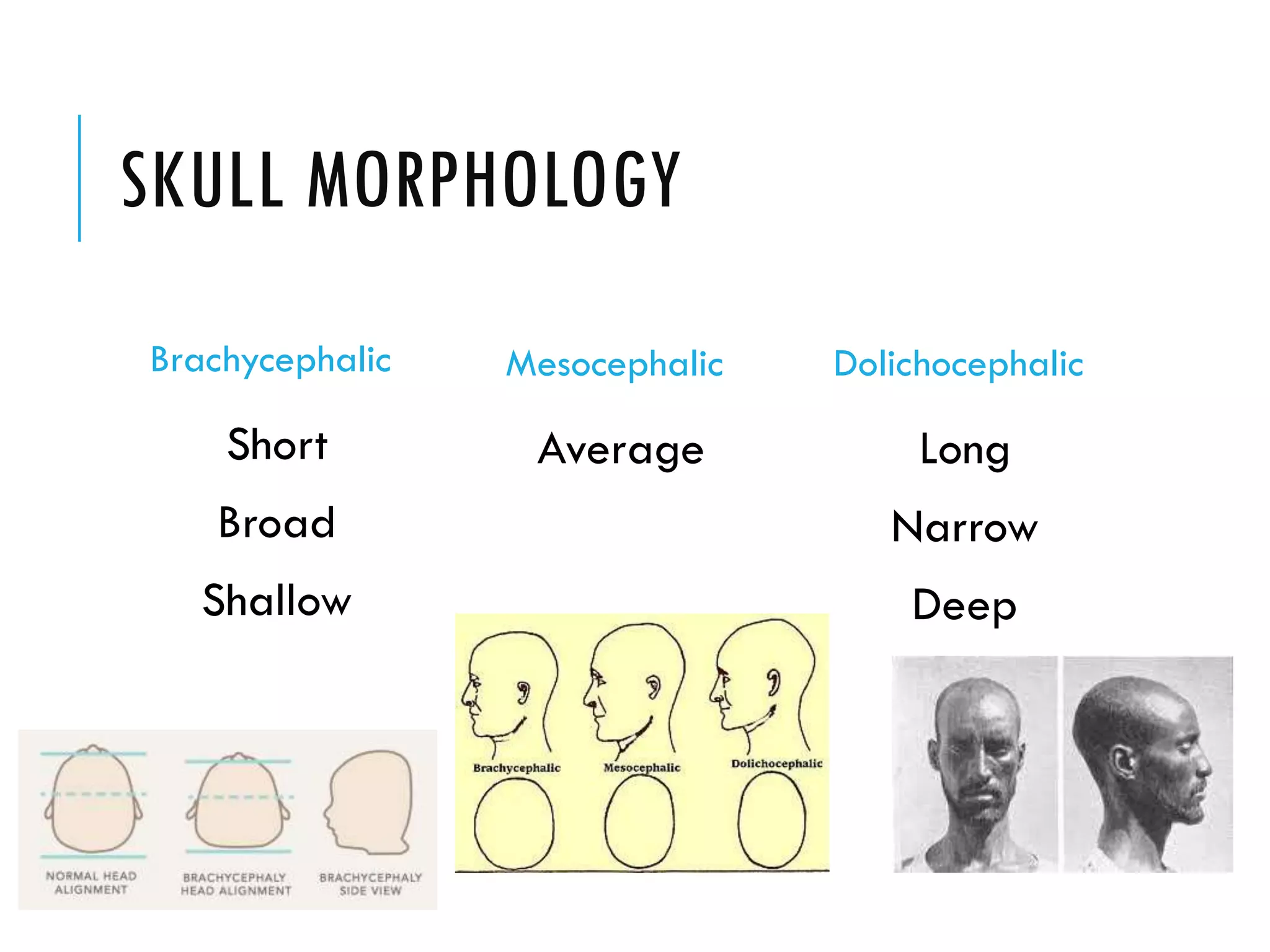 SKULL MORPHOLOGY
Brachycephalic
Short
Broad
Shallow
Mesocephalic
Average
Dolichocephalic
Long
Narrow
Deep
 