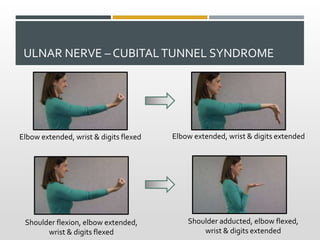 ULNAR NERVE – CUBITALTUNNEL SYNDROME
Elbow extended, wrist & digits flexed Elbow extended, wrist & digits extended
Shoulder adducted, elbow flexed,
wrist & digits extended
Shoulder flexion, elbow extended,
wrist & digits flexed
 