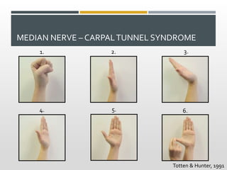 MEDIAN NERVE – CARPALTUNNEL SYNDROME
1. 2. 3.
4. 5. 6.
Totten & Hunter, 1991
 