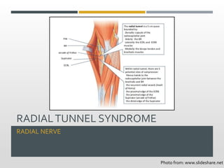 RADIALTUNNEL SYNDROME
RADIAL NERVE
Photo from: www.slideshare.net
 