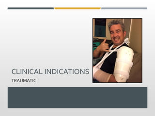 CLINICAL INDICATIONS
TRAUMATIC
 