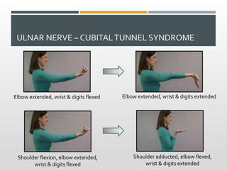 Nerve Gliding Exercises - Excursion and Valuable Indications for Therapy Slide 27