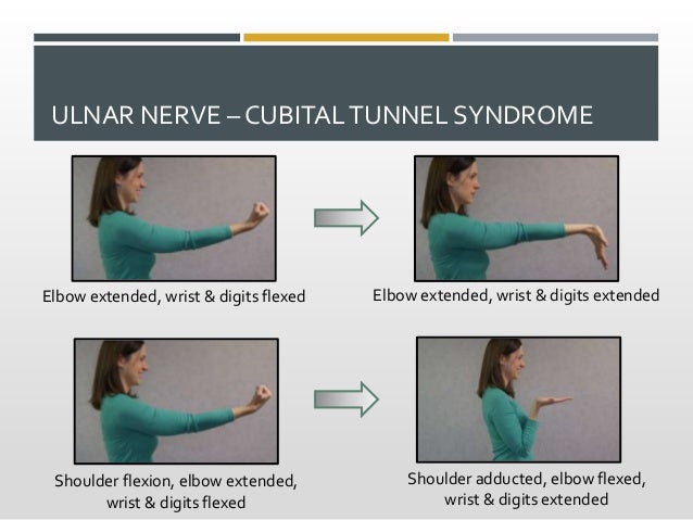 Nerve Gliding Exercises Excursion And Valuable Indications For Ther