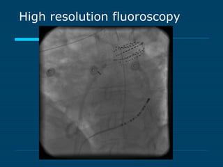 High resolution fluoroscopy
 