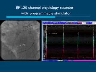 EP 120 channel physiology recorder
with programmable stimulator
 