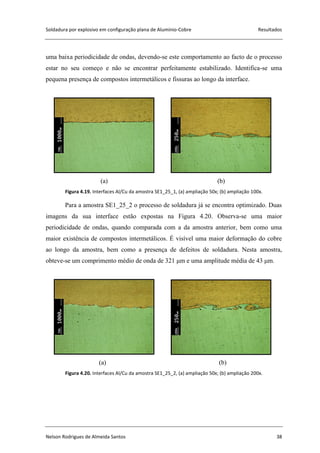 Soldadura por explosivo em configuração plana de Alumínio-Cobre Resultados
Nelson Rodrigues de Almeida Santos 38
uma baixa periodicidade de ondas, devendo-se este comportamento ao facto de o processo
estar no seu começo e não se encontrar perfeitamente estabilizado. Identifica-se uma
pequena presença de compostos intermetálicos e fissuras ao longo da interface.
(a) (b)
Figura 4.19. Interfaces Al/Cu da amostra SE1_25_1, (a) ampliação 50x; (b) ampliação 100x.
Para a amostra SE1_25_2 o processo de soldadura já se encontra optimizado. Duas
imagens da sua interface estão expostas na Figura 4.20. Observa-se uma maior
periodicidade de ondas, quando comparada com a da amostra anterior, bem como uma
maior existência de compostos intermetálicos. É visível uma maior deformação do cobre
ao longo da amostra, bem como a presença de defeitos de soldadura. Nesta amostra,
obteve-se um comprimento médio de onda de 321 μm e uma amplitude média de 43 μm.
(a) (b)
Figura 4.20. Interfaces Al/Cu da amostra SE1_25_2, (a) ampliação 50x; (b) ampliação 200x.
 