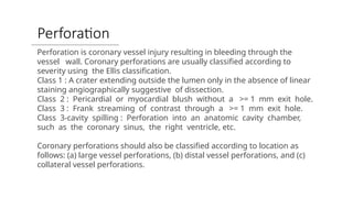 Perforation Classification Comprehensive Guide to Diagnostic Coronary Angiography (DCA) Procedure ...