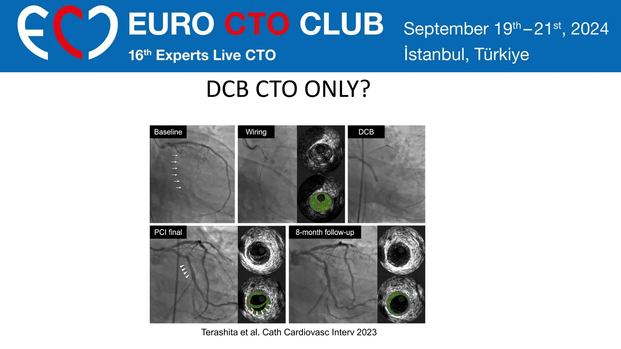 DCB CTO ONLY?
Terashita et al. Cath Cardiovasc Interv 2023