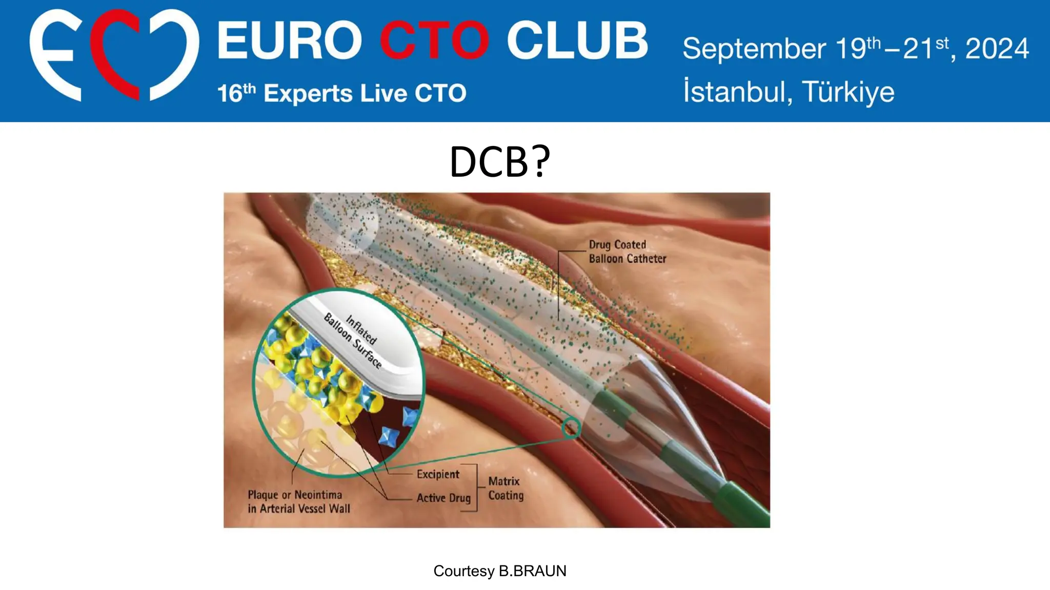 DCB?
Courtesy B.BRAUN