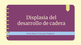 Displasia del
desarrollo de cadera
Grace Naomi Terrones Chaparro
 