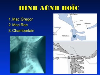 HÌNH AÛNH HOÏC
1. Mac Gregor
2. Mac Rae
3. Chamberlain

 