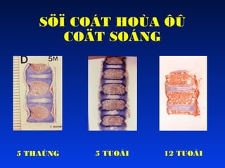 SÖÏ COÁT HOÙA ÔÛ
COÄT SOÁNG

5 THAÙNG

5 TUOÅI

12 TUOÅI

 